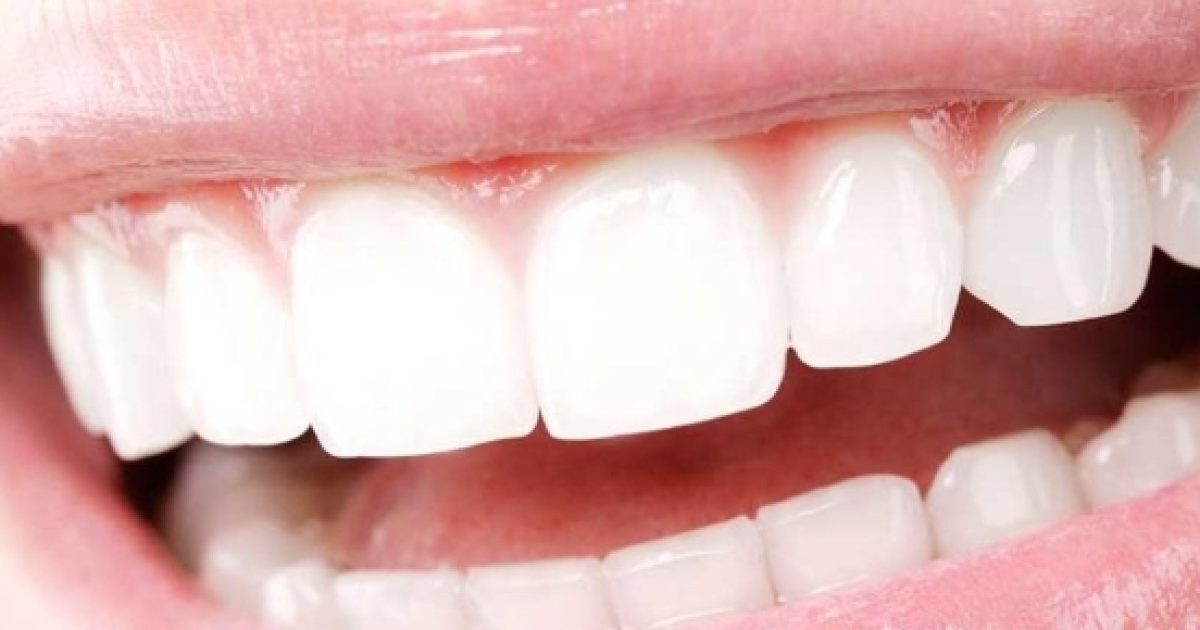 Красивые зубы. Красивые зубы. Профессиональное домашнее отбеливание зубов. Sparkling smile. Красивые зубы на белом фоне.