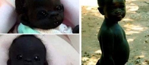 Lembra do bebê mais negro do mundo? Pois é, a verdade veio à tona