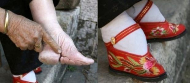 Durante os séculos 10 e 11, na China, as jovens usavam sapatos que impediam o crescimento dos pés e forçavam uma dolorosa curvatura nos dedos Durante os séculos 10 e 11, na China, as jovens usavam sapatos que impediam o crescimento dos pés e forçavam uma dolorosa curvatura nos dedos