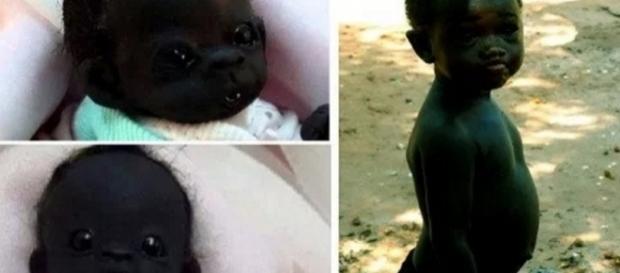 Lembra do bebê mais negro do mundo? Pois é, a verdade veio à tona Lembra do bebê mais negro do mundo? Pois é, a verdade veio à tona