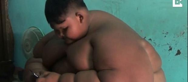 o garoto indonésio de 10 anos que passou a pesar 190 quilos depois de ingerir muito macarrão instantâneo. Foto: Jornal Ciência o garoto indonésio de 10 anos que passou a pesar 190 quilos depois de ingerir muito macarrão instantâneo. Foto: Jornal Ciência
