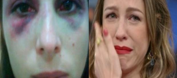 Luana Piovani tem ex-namorado preso por agressão a Aída Nunes (à esquerda) - Google Luana Piovani tem ex-namorado preso por agressão a Aída Nunes (à esquerda) - Google