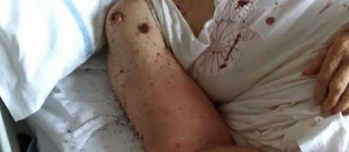 Choc a Napoli, donna abbandonata in letto d'ospedale tra le formiche - foto: grandenapoli.it