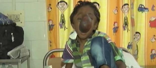 O garoto está internado a espera de uma cirurgia. (Foto/Google) O garoto está internado a espera de uma cirurgia. (Foto/Google)