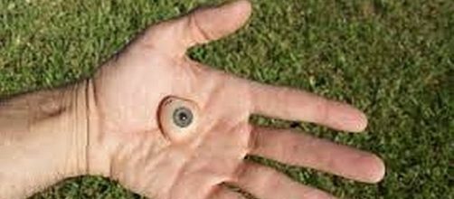 Divers rescued man's prosthetic eye from pool - Flickr.com