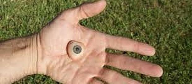 Divers rescued man's prosthetic eye from pool - Flickr.com Divers rescued man's prosthetic eye from pool - Flickr.com