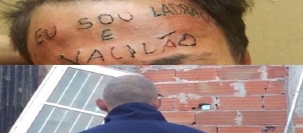 Prefeitura irá custear o tratamento do jovem. (Foto/Google) Prefeitura irá custear o tratamento do jovem. (Foto/Google)