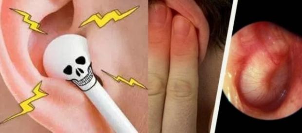 Usar muito fone de ouvido pode levar a doenças graves Usar muito fone de ouvido pode levar a doenças graves