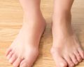 The best natural remedies to treat bunions