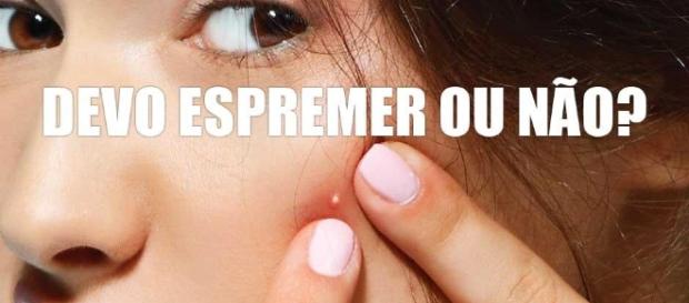 5 dicas para evitar as espinhas e o possível mal que elas podem ... - hypescience.com 5 dicas para evitar as espinhas e o possível mal que elas podem ... - hypescience.com