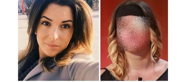 Ele deformou o rosto da ex-namorado com ácido Ele deformou o rosto da ex-namorado com ácido