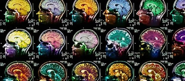 Study Identifies the Brain Parts and Functions Involved in Dreaming - Study Identifies the Brain Parts and Functions Involved in Dreaming -