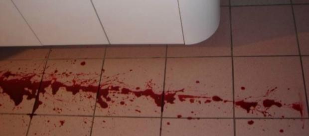 Homem foi atacado quando estava no banheiro Homem foi atacado quando estava no banheiro