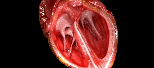 Heart valve - Wikipedia - wikipedia.org creative commons Heart valve - Wikipedia - wikipedia.org creative commons