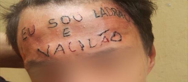 Menor tatuado em São Paulo realiza primeira sessão de remoção Menor tatuado em São Paulo realiza primeira sessão de remoção