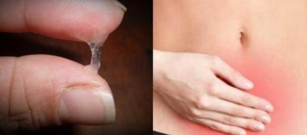 Mudança na cor do corrimento vaginal pode indicar doença Mudança na cor do corrimento vaginal pode indicar doença