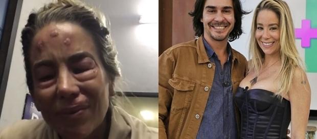Fãs não aprovaram as imagens feitas por Cacau Protássio Fãs não aprovaram as imagens feitas por Cacau Protássio
