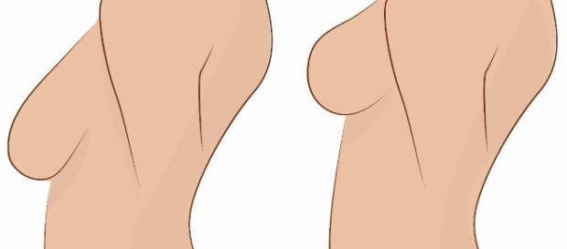 Movimentos que irão levantar os seus seios naturalmente, sem cirurgia Movimentos que irão levantar os seus seios naturalmente, sem cirurgia