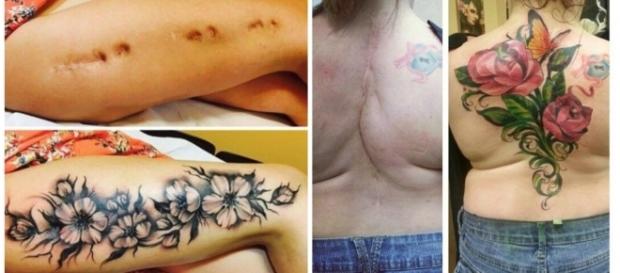 Antes e depois de cicatrizes que foram tatuadas Antes e depois de cicatrizes que foram tatuadas