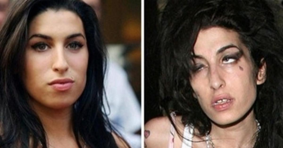 6 celebridades antes e depois das drogas