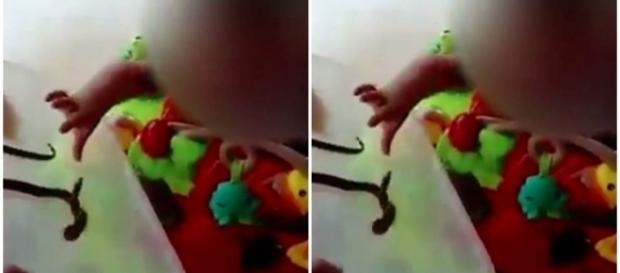 Bebê de um ano é picado por cobra Bebê de um ano é picado por cobra