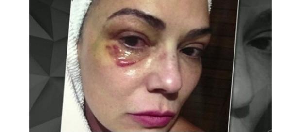 Empresário foi condenado a 1 ano de prisão por lesão corporal contra Luiza Brunet Empresário foi condenado a 1 ano de prisão por lesão corporal contra Luiza Brunet