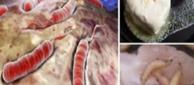 Médicos alertam sobre quais alimentos não devem ser ingeridos ou evitados - Google Médicos alertam sobre quais alimentos não devem ser ingeridos ou evitados - Google