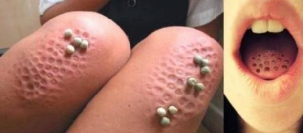 Teste para saber se você tem tripofobia Teste para saber se você tem tripofobia