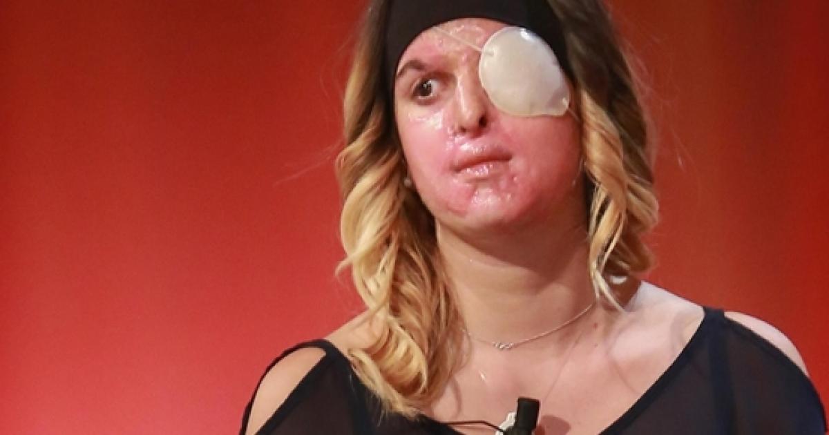 Cornea ragazza foto