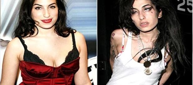 Amy Winehouse: famosos que mudaram de aparência drasticamente após o uso de drogas Amy Winehouse: famosos que mudaram de aparência drasticamente após o uso de drogas