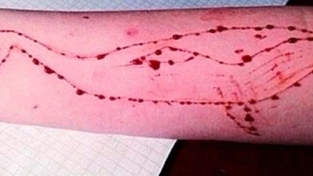 Blue Whale Challenge in Italia: un altro caso sospetto nella nostra penisola