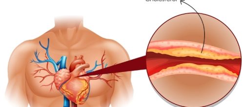 8 Ways to Reduce Bad Cholesterol without Medication | Fab How - fabhow.com