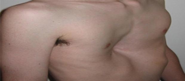 Em alguns casos, é necessário que o paciente se submeta a um processo cirúrgico. (Foto/Google) Em alguns casos, é necessário que o paciente se submeta a um processo cirúrgico. (Foto/Google)
