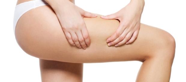 How to Get Rid of Cellulite | StyleCaster - stylecaster.com How to Get Rid of Cellulite | StyleCaster - stylecaster.com