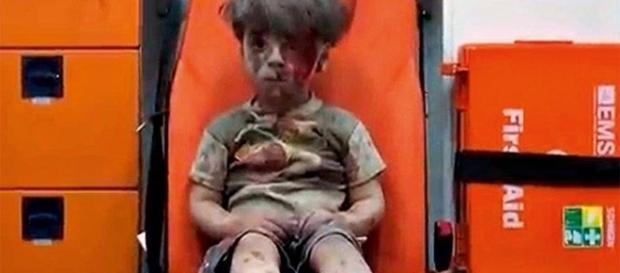 Ele chamou a atenção do mundo após sobreviver a um bombardeio Ele chamou a atenção do mundo após sobreviver a um bombardeio