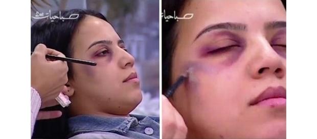 TV marroquina revolta ao ensinar como esconder hematomas de agressão doméstica TV marroquina revolta ao ensinar como esconder hematomas de agressão doméstica