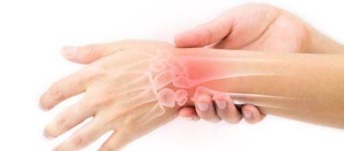 trattamento fisioterapico per l'artrite reumatoide | Pazienti.it - pazienti.it