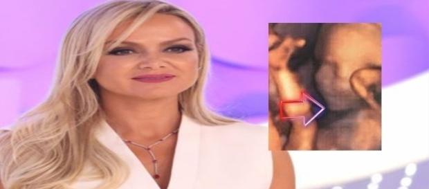 Apresentadora do SBT comove o Brasil com seu drama. ( Foto: Reprodução) Apresentadora do SBT comove o Brasil com seu drama. ( Foto: Reprodução)