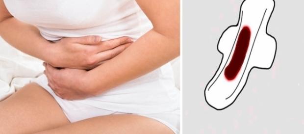 Confira as causas da menstruação preta, marrom ou tipo borra de café Confira as causas da menstruação preta, marrom ou tipo borra de café