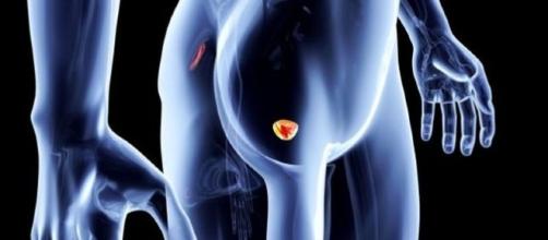 Caffé e tumore alla prostata: il legame è racchiuso in 3 tazzine ... - velvetbody.it