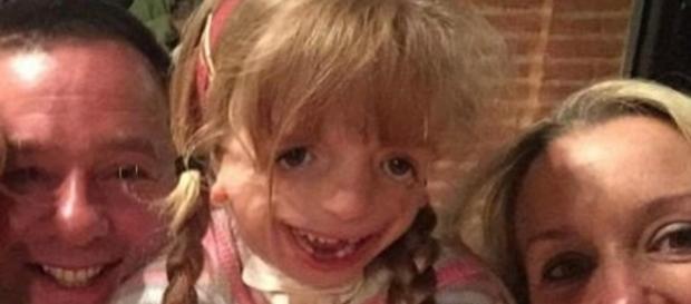 A síndrome de Treacher Collins é uma condição grave e rara (Foto internet) A síndrome de Treacher Collins é uma condição grave e rara (Foto internet)