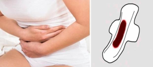 Conheça os sinais de que a menstruação apresenta algo errado - Google Conheça os sinais de que a menstruação apresenta algo errado - Google