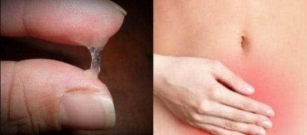 Cor do corrimento vaginal pode dizer muito Cor do corrimento vaginal pode dizer muito