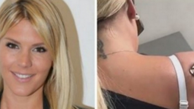 Les Vacances des Anges 2 : Amélie Neten se fait retirer ses tatouages au laser et en explique la raison.