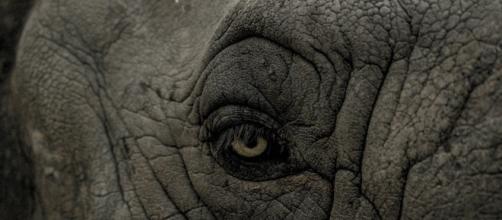 A doença do homem elefante, chamada de 'síndrome de Proteus', é congênita e também muito rara. ( Foto: Google)