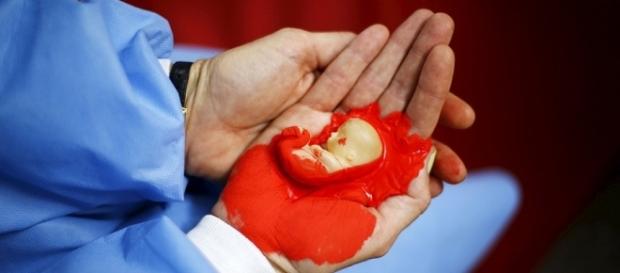 La Cámara Alta decide este martes la despenalización del aborto en Chile La Cámara Alta decide este martes la despenalización del aborto en Chile