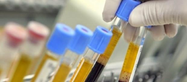 Equipamento criado no Brasil pode ajudar em diagnósticos e exames comuns Equipamento criado no Brasil pode ajudar em diagnósticos e exames comuns