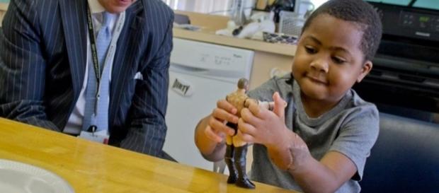 Zion Harvey foi a primeira criança no mundo a passar por uma cirurgia dupla de transplante de mãos Zion Harvey foi a primeira criança no mundo a passar por uma cirurgia dupla de transplante de mãos
