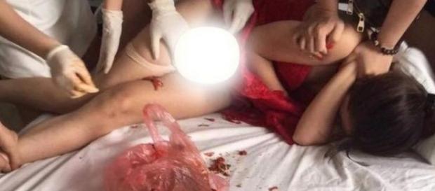 Mulher é alvo de ataque de pimenta - Google Mulher é alvo de ataque de pimenta - Google