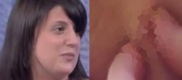 Mulher tem 9 mamilos e surpreende com drama (Foto: Reprodução/ Montagem) Mulher tem 9 mamilos e surpreende com drama (Foto: Reprodução/ Montagem)